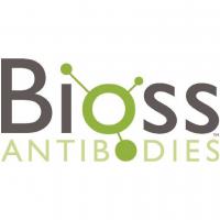 Bioss 美国最大抗体平台